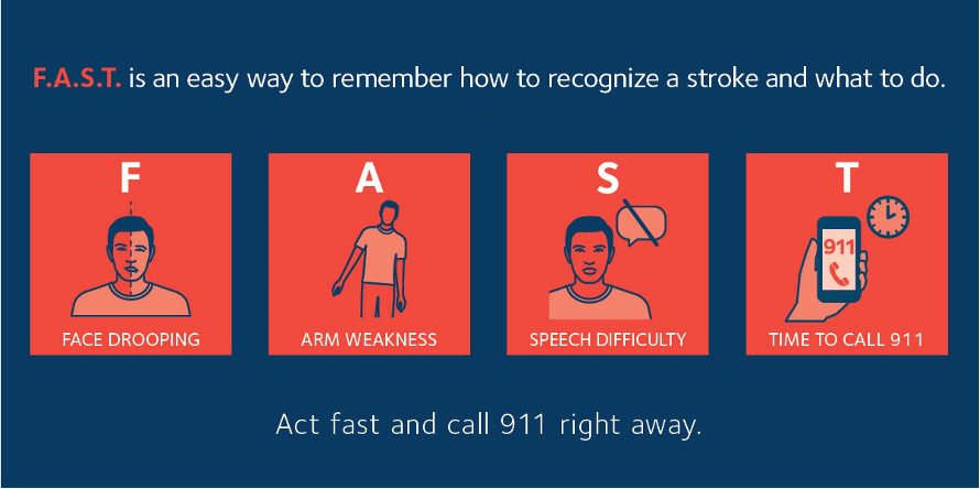 How to identify and prevent a stroke - Adventist Health Northwest Heart ...